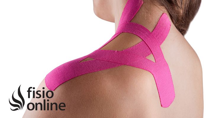 ¿Cómo nos ayuda el Kinesiotape para tratar las Tendinopatías? 