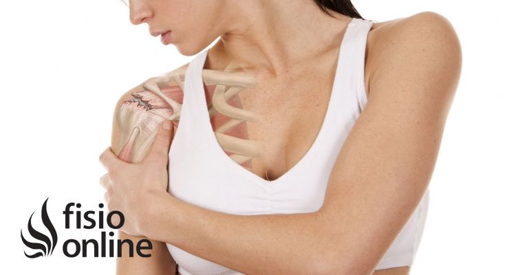 tendinitis en el hombro izquierdo sintomas
