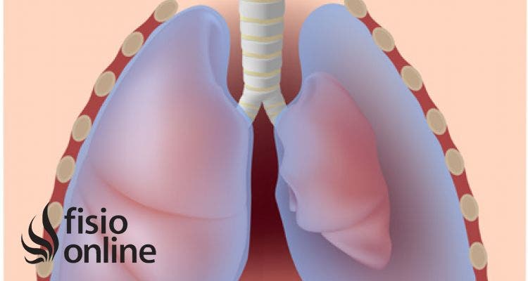 Neumotorax, clínica y clasificación