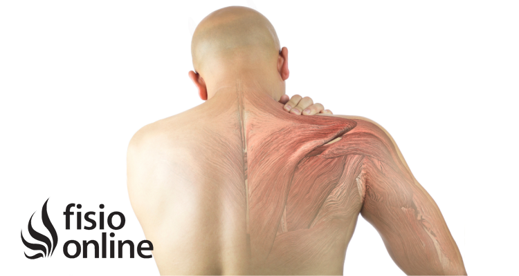 Cómo la fascia y las tensiones viscerales pueden estar afectando tu tendinopatía de hombro