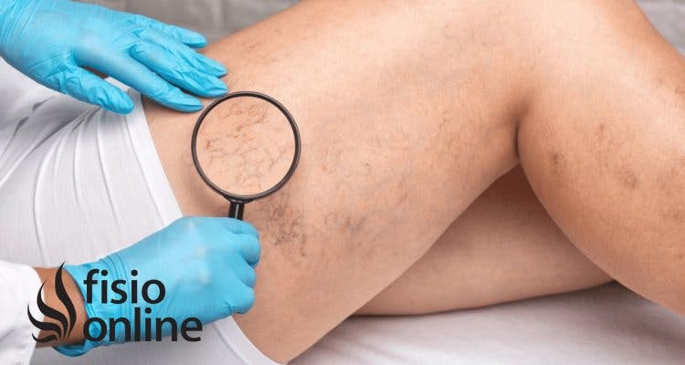 Cómo mejorar la circulación de las piernas: consejos, remedios naturales y ejercicios