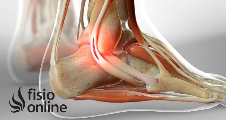 5 Curiosidades que no sabías sobre los ligamentos, su estructura y su funcionamiento