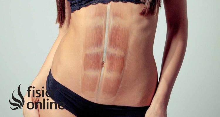 Diástasis abdominal: Qué es, tratamiento y consejos para tener un abdomen funcional