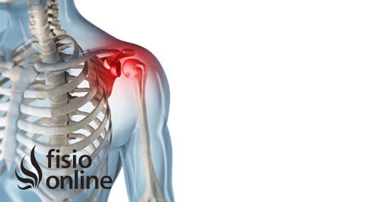 Luxaciones acromioclaviculares