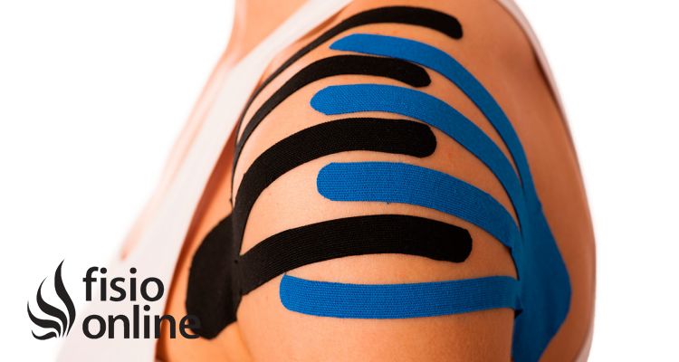 Kinesio Taping. ¿Cuál es su verdadero mecanismo de acción?