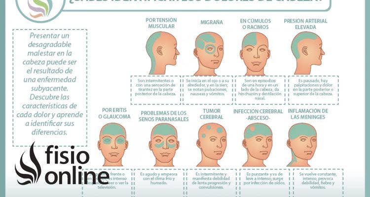 Los diferentes dolores de cabeza, conoce las características de cada cefalea