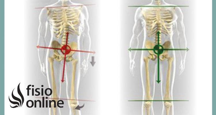 Equilibrio postural y disfunciones articulares o como las postura afecta a nuestro organismo