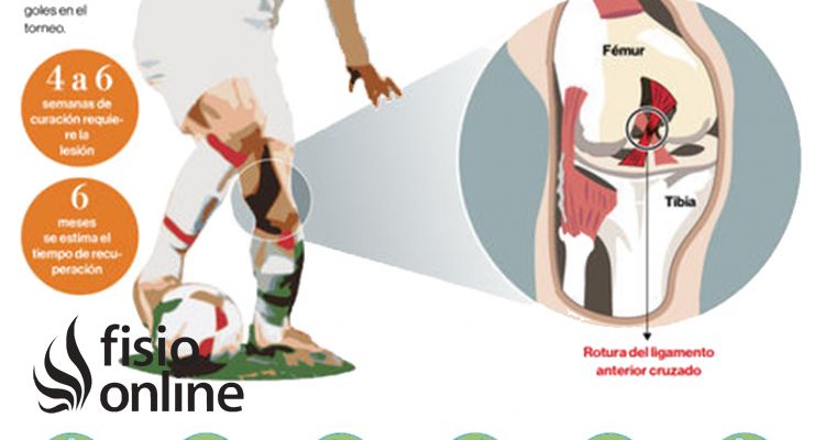 El castigo del futbolista, conoce todos los detalles sobre la lesión de ligamento cruzado de la rodilla El castigo del futbolista, conoce todos los detalles sobre la lesión de ligamento cruzado de la rodilla