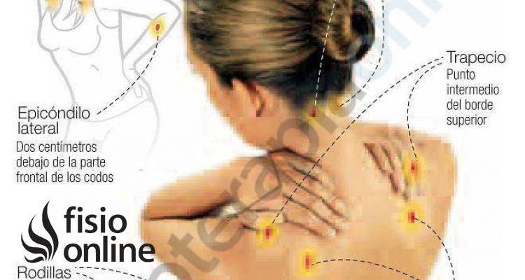 La fibromialgia, un trastorno que enfoca tu cerebro hacia el dolor