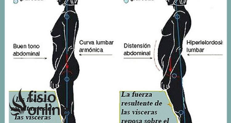 La postura y el suelo pélvico femenino están íntimamente relacionados, aprende porque