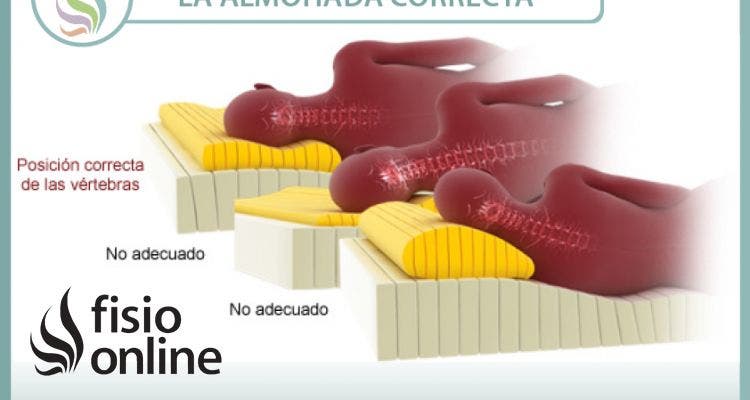 La almohada, la cabeza de turco de los dolores cervicales, ¿Es la culpable?