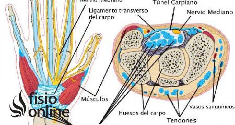 Síndrome del túnel carpiano. Causas y tratamiento