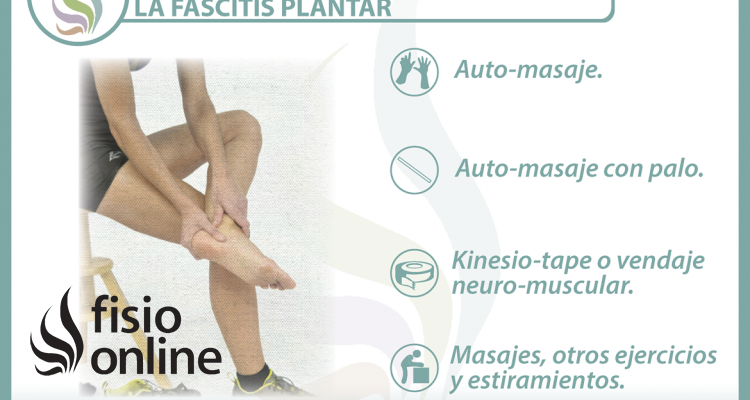 4 claves para entender y tratar la fascitis plantar