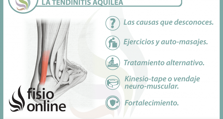 5 claves para entender y tratar la tendinitis aquilea