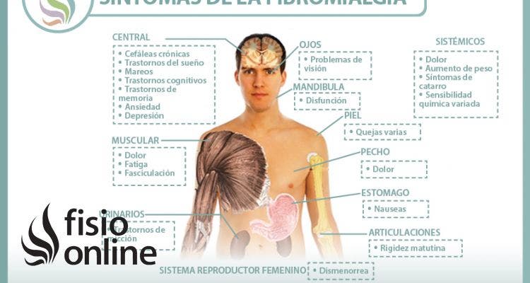 Fibromialgia. Causas, sintomas, diagnóstico y tratamiento