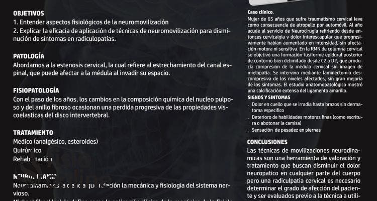 Eficacia de la neurodinamia para la reducción de síntomas en radiculopatia cervical