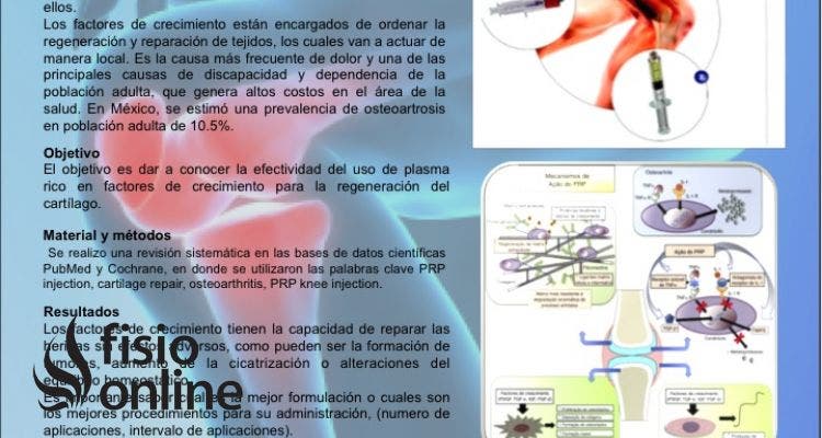 El uso del plasma rico en factores de crecimiento en la regeneración del cartílago