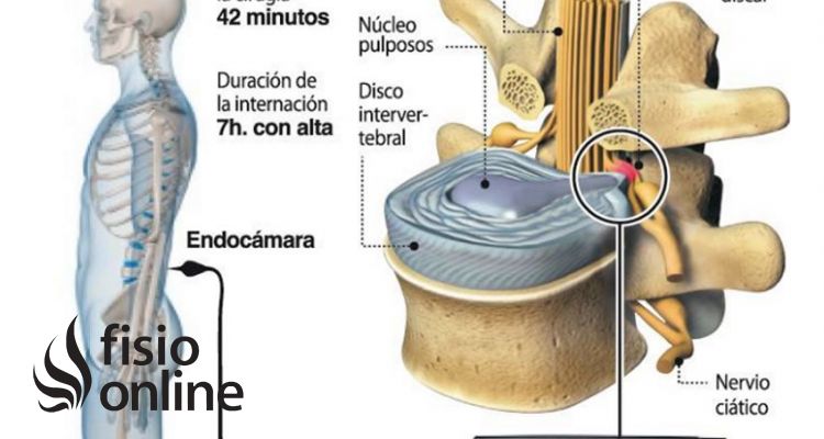 El avance de la videoendoscopia El avance de la videoendoscopia