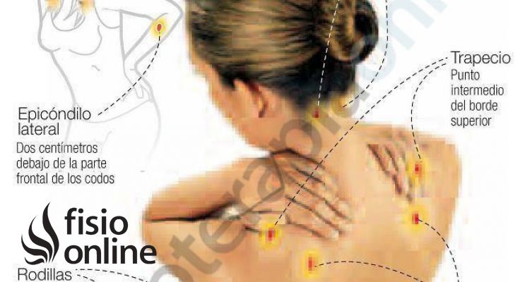 La fibromialgia, un trastorno que enfoca tu cerebro hacia el dolor