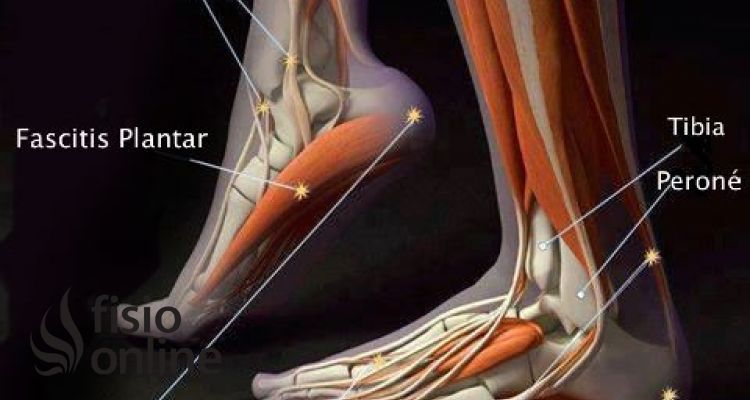 Lesiones y disfunciones del pie, conoce a los principales causantes