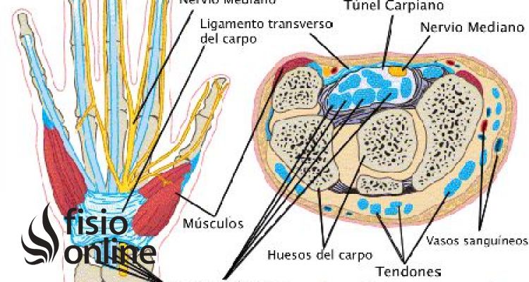 Síndrome del túnel carpiano. Causas y tratamiento