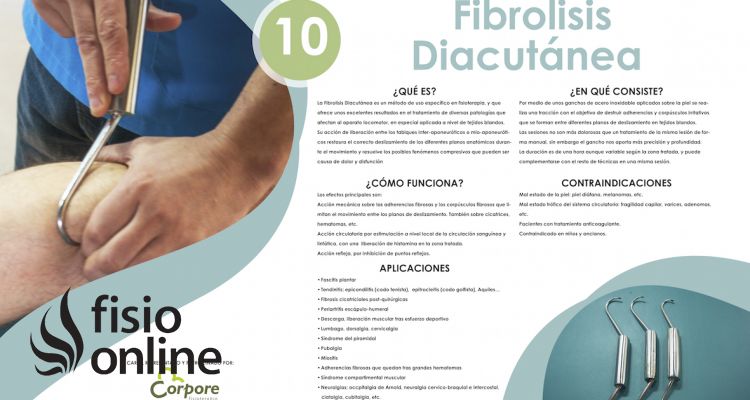 Fibrolisis Diacutanea o Técnica de ganchos. Te ayuda más de lo que te asusta