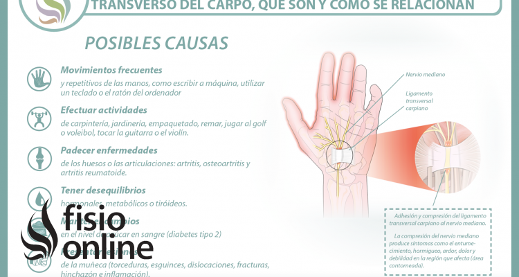 El síndrome del túnel carpiano y el ligamento transverso del carpo, aprende qué son y cómo se relacionan