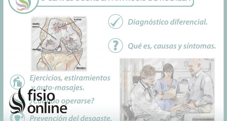 5 claves sobre la artrosis de rodilla