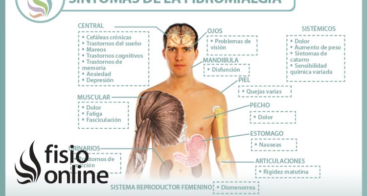 Fibromialgia. Causas, sintomas, diagnóstico y tratamiento