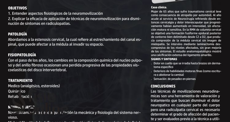 Eficacia de la neurodinamia para la reducción de síntomas en radiculopatia cervical Eficacia de la neurodinamia para la reducción de síntomas en radiculopatia cervical
