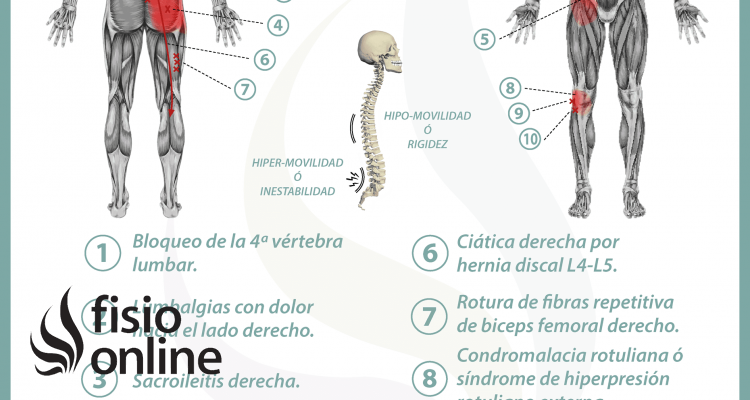 Relación del intestino delgado con el dolor de espalda