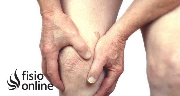 Rodilla artrítica: qué es, factores de riesgo, diagnóstico y opciones de tratamiento