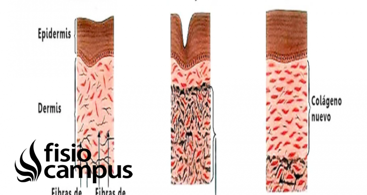 Elastina Qué es, quién la produce, mecanismo de acción y cómo