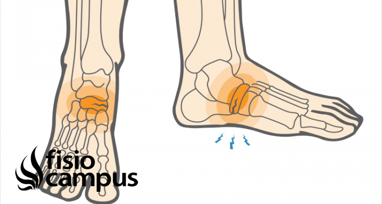 Escafoides O Navicular Que Es Significado Donde Esta Funcion Y Lesiones