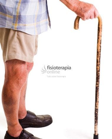 Uso Del Baston Como Apoyo Para La Marcha Fisioonline