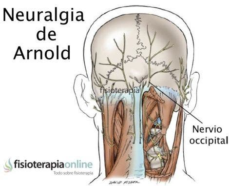 El dolor en la espalda la inflamación fácil