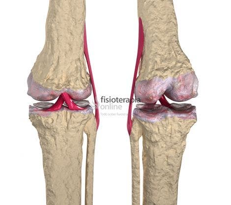 Durerile articulare | Cauze, simptome si tratamente – Voltaren