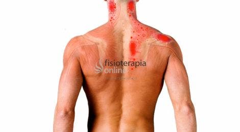 Deltoid hipertónia. DR. VÁSÁRHELYI BARNA cikkei