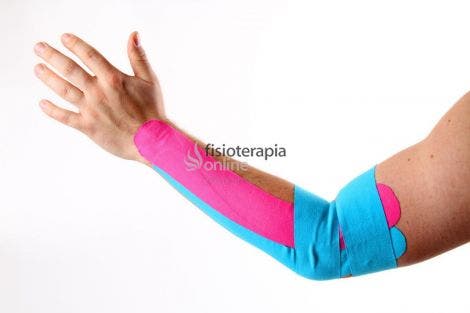 dinosaurio Interrupción Te mejorarás Kinesiotaping… cuando SI y cuando NO!! Indicaciones y contraindicaciones de  su aplicación | FisioOnline