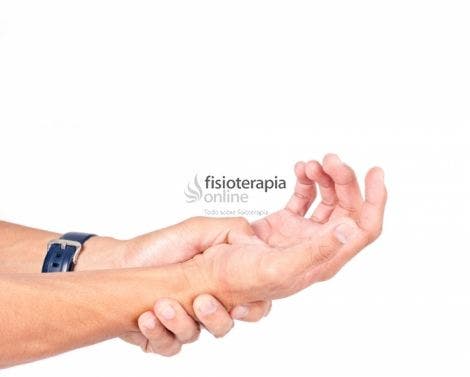 Sindrome Doloroso Regional Complejo O Distrofia Simpatico Refleja Causas Y Tratamiento Fisioterapeutico Fisioonline