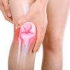 ¿Qué es una bursitis de rodilla? Causas, diagnóstico y tratamiento en fisioterapia y medicina