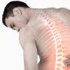 ¿En qué consiste el tratamiento de fisioterapia del acuñamiento vertebral?