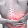 Diagnóstico de la dorslagia o dolor de espalda crónico. Cómo saber si la padeces.