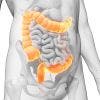 ¿Cómo repercute la disfunción Colon Irritable sobre el sistema Músculo-esquelético?