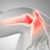 Bursitis, Tendinitis y Síndrome Subacromial: ¿Cómo Diferenciarlos y Tratarlos Correctamente?