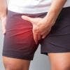 Diagnóstico de la pubalgia u osteopatía de pubis. Cómo saber si la padeces.