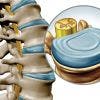 5 Curiosidades que no sabías sobre el disco intervertebral, su estructura y su funcionamiento