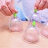 Qué es el Cupping Therapy (Ventosas), para que sirve y como funciona