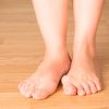 Hallux valgus o Juanetes. Qué es, causas, síntomas y tratamiento