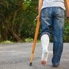 ¿Cómo usar las muletas en caso de fracturas de tibia?